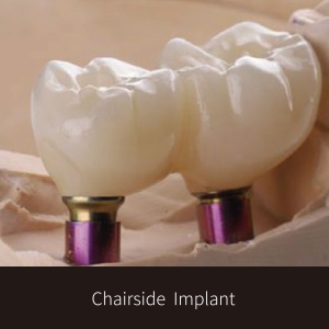 Dentitude Implant